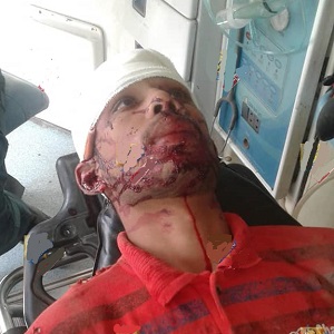  سمندری143 گ ب گوجرہ روڈ پر کار موٹر سائیکل تصادم نوجوان شدید زخمی